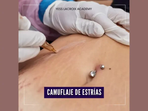 Curso Camuflaje de Estrías Yess Lacroix